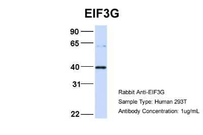 Western Blot: EIF3G Antibody [NBP3-10537] - Host: Rabbit. Target Name: EIF3G. Sample Type: 293T. Antibody Dilution: 1.0ug/ml EIF3G is supported by BioGPS gene expression data to be expressed in HEK293T